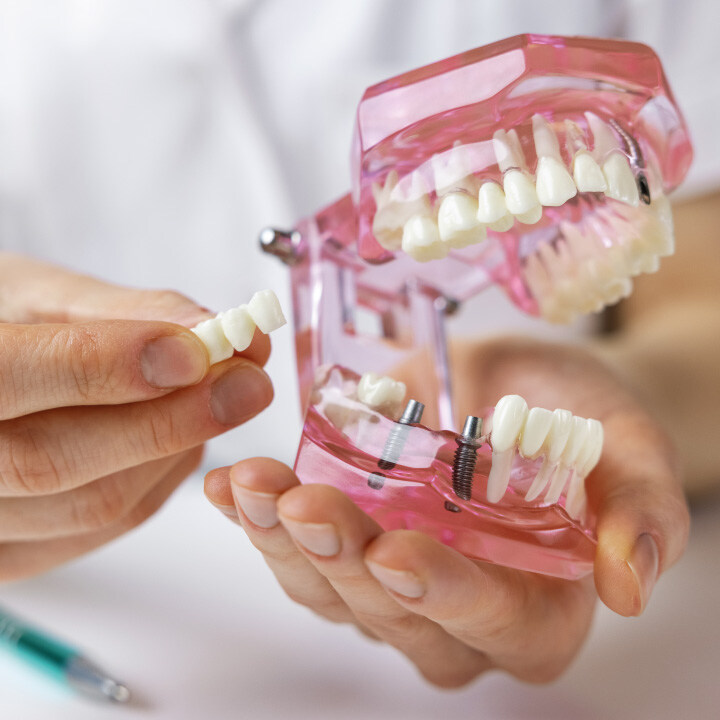 Web_DIP-en-Implantologia-Oral2 (1)