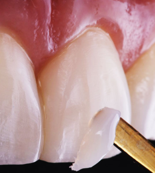 imagen2-Odontologia-estetica