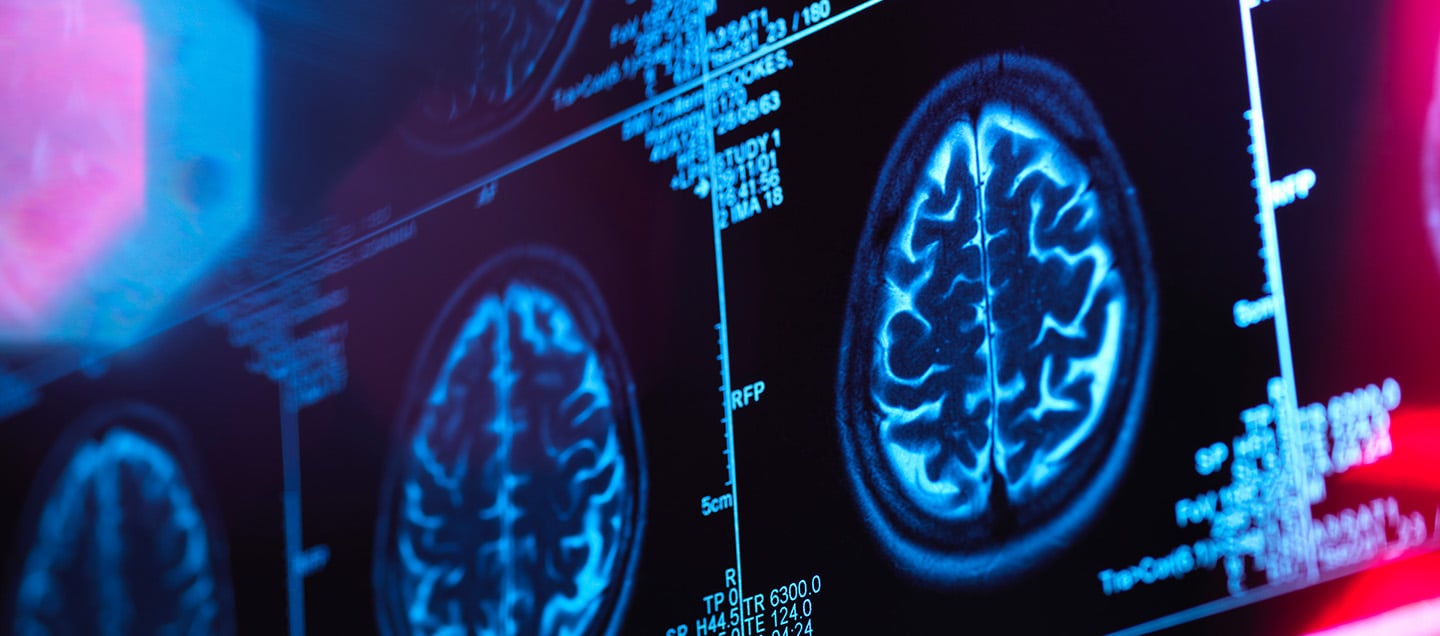 foto del articulo Brain Wave, tecnología portátil para la salud neurológica